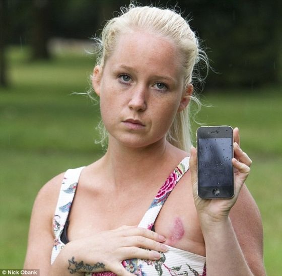 英国女子抱iPhone入睡 胸部被灼伤
