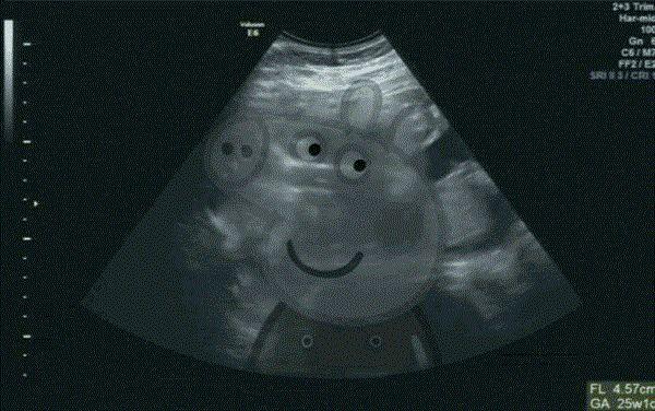 怀孕搞笑表情包图片